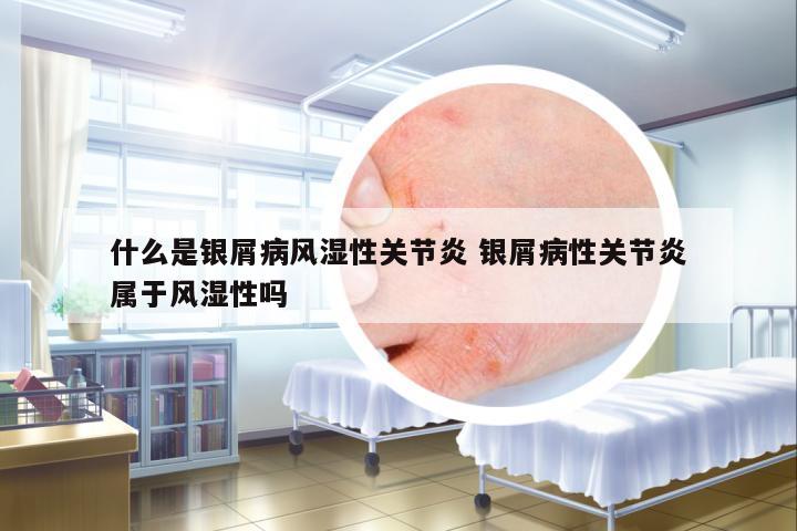 什么是銀屑病風(fēng)濕性關(guān)節(jié)炎 銀屑病性關(guān)節(jié)炎屬于風(fēng)濕性嗎