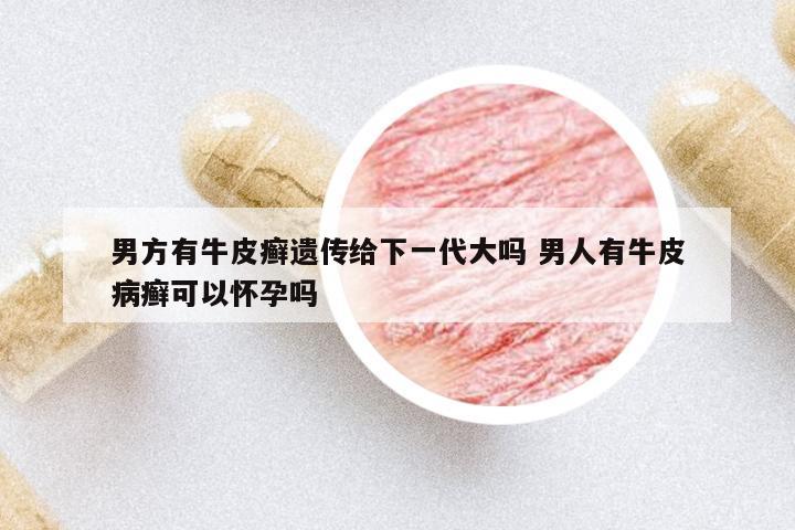 男方有牛皮癬遺傳給下一代大嗎 男人有牛皮病癬可以懷孕嗎