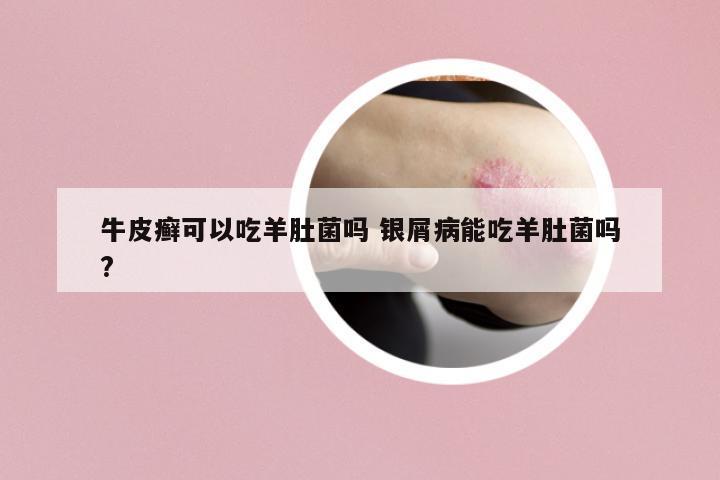 牛皮癬可以吃羊肚菌嗎 銀屑病能吃羊肚菌嗎?