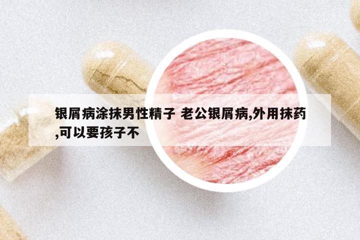 銀屑病涂抹男性精子 老公銀屑病,外用抹藥,可以要孩子不