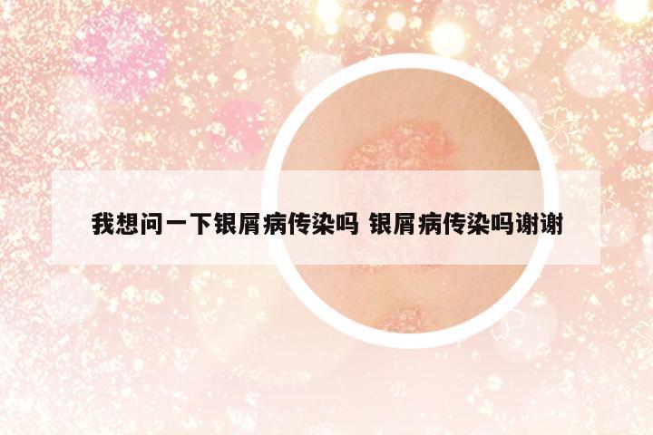 我想問一下銀屑病傳染嗎 銀屑病傳染嗎謝謝