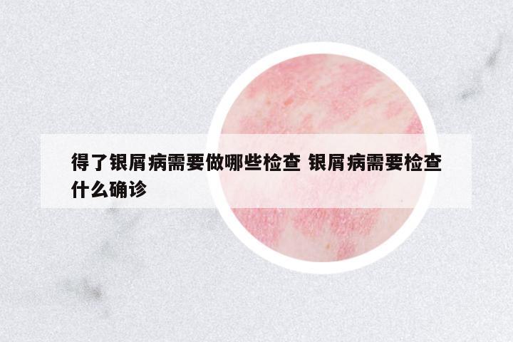 得了銀屑病需要做哪些檢查 銀屑病需要檢查什么確診