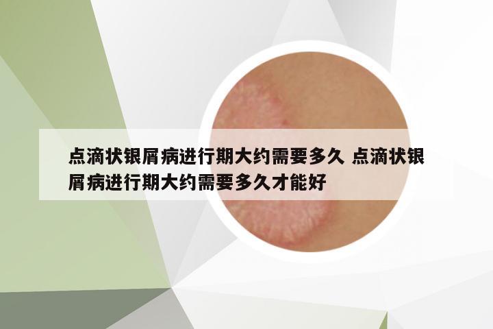點(diǎn)滴狀銀屑病進(jìn)行期大約需要多久 點(diǎn)滴狀銀屑病進(jìn)行期大約需要多久才能好