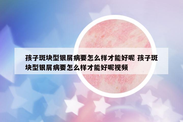 孩子斑塊型銀屑病要怎么樣才能好呢 孩子斑塊型銀屑病要怎么樣才能好呢視頻