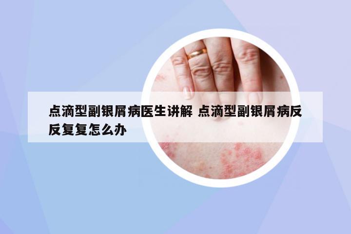 點(diǎn)滴型副銀屑病醫(yī)生講解 點(diǎn)滴型副銀屑病反反復(fù)復(fù)怎么辦