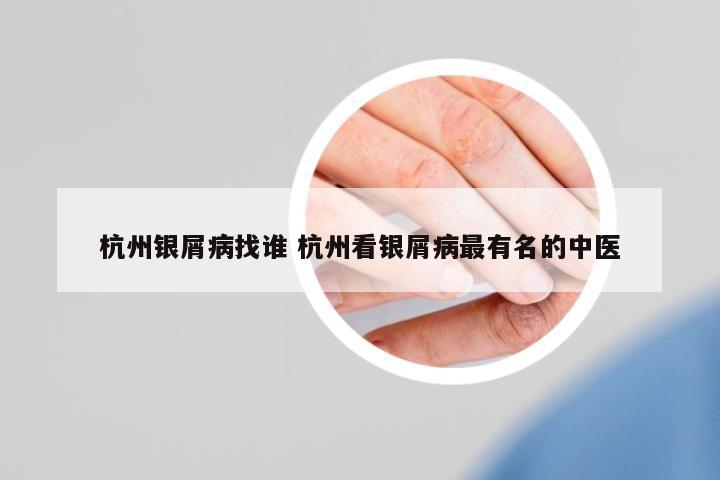 杭州銀屑病找誰(shuí) 杭州看銀屑病最有名的中醫(yī)