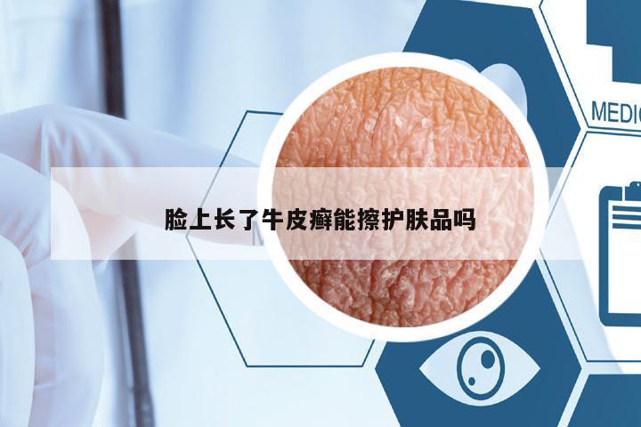 臉上長了牛皮癬能擦護(hù)膚品嗎
