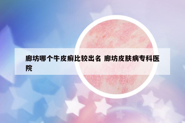 廊坊哪個牛皮癬比較出名 廊坊皮膚病專科醫(yī)院