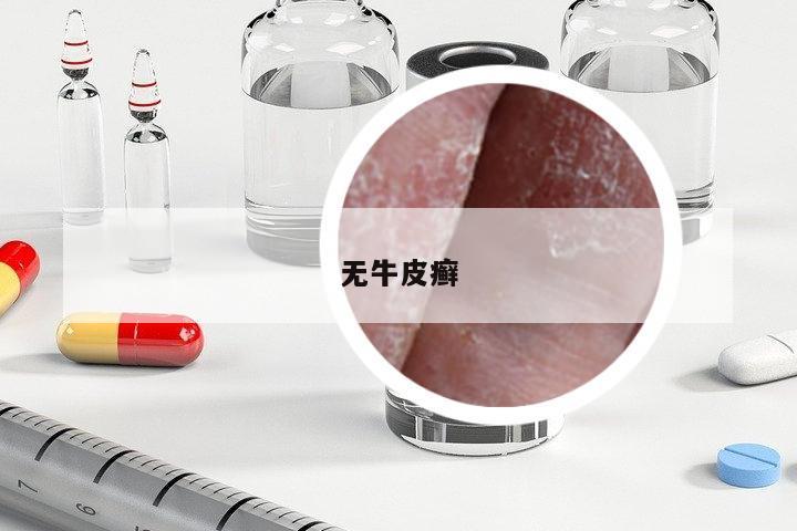 無(wú)牛皮癬