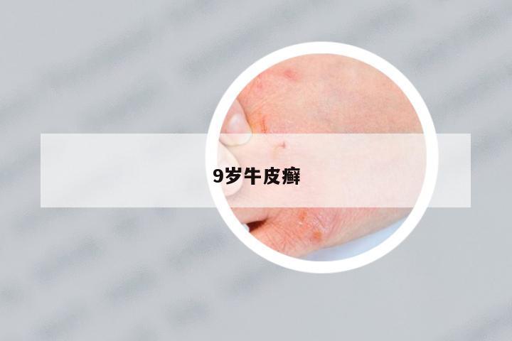 9歲牛皮癬