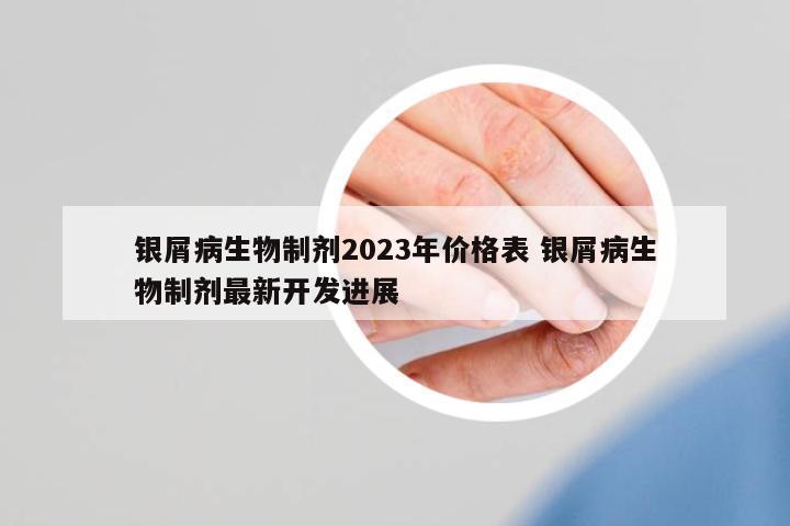 銀屑病生物制劑2023年價(jià)格表 銀屑病生物制劑最新開發(fā)進(jìn)展