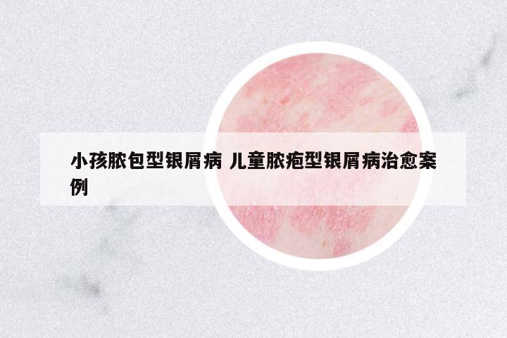 小孩膿包型銀屑病 兒童膿皰型銀屑病治愈案例
