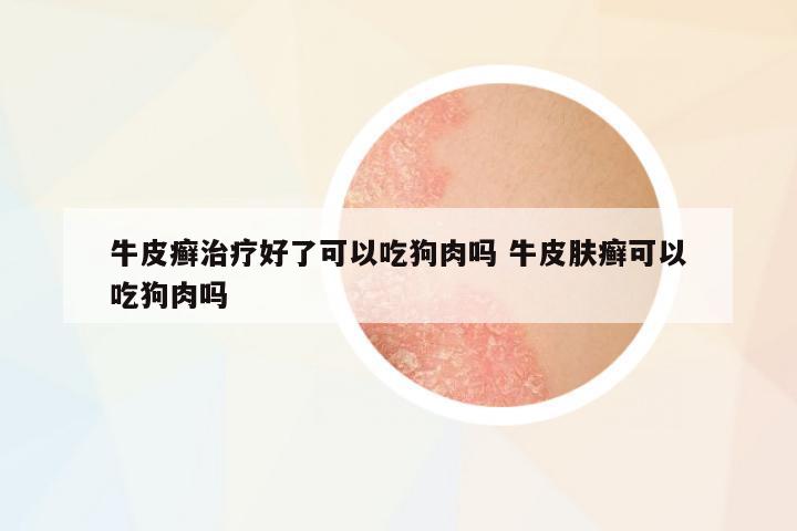 牛皮癬治療好了可以吃狗肉嗎 牛皮膚癬可以吃狗肉嗎