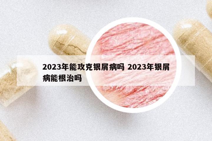 2023年能攻克銀屑病嗎 2023年銀屑病能根治嗎