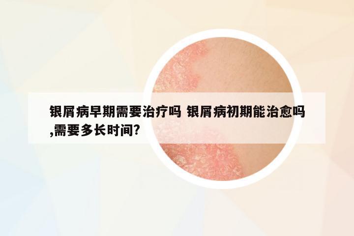 銀屑病早期需要治療嗎 銀屑病初期能治愈嗎,需要多長時(shí)間?