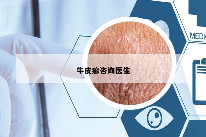牛皮癬咨詢醫(yī)生