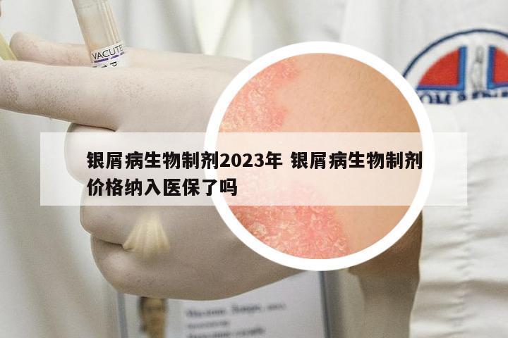 銀屑病生物制劑2023年 銀屑病生物制劑價格納入醫(yī)保了嗎