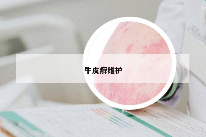 牛皮癬維護
