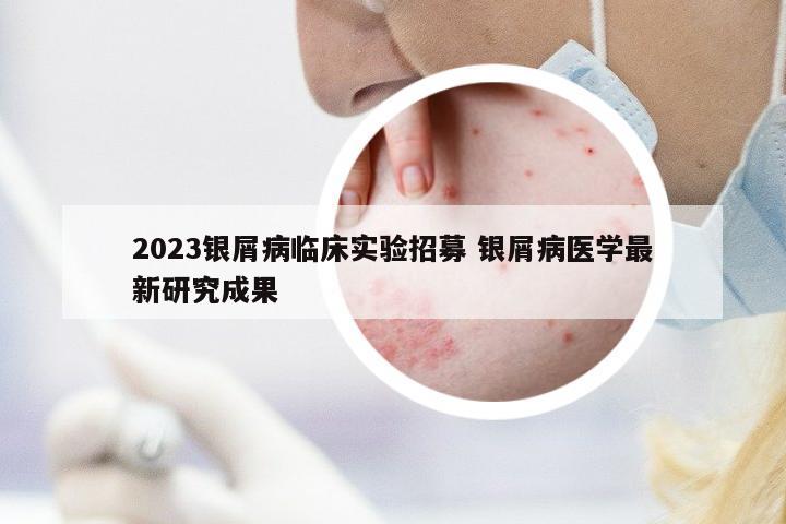 2023銀屑病臨床實驗招募 銀屑病醫(yī)學(xué)最新研究成果