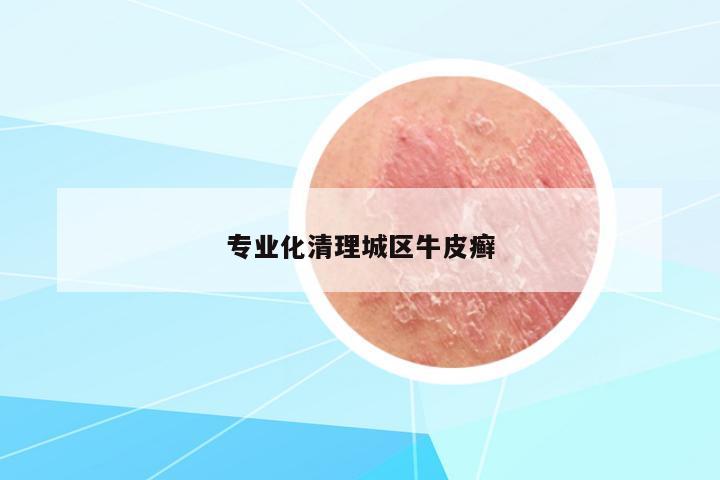 專業(yè)化清理城區(qū)牛皮癬