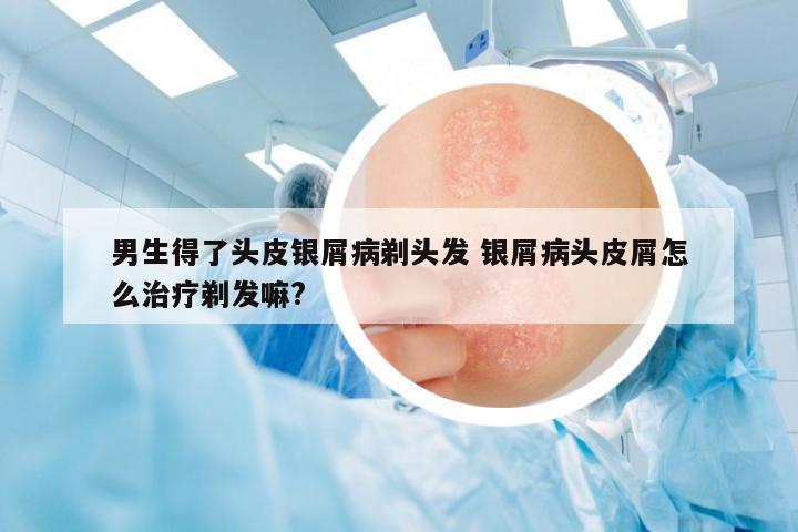 男生得了頭皮銀屑病剃頭發(fā) 銀屑病頭皮屑怎么治療剃發(fā)嘛?