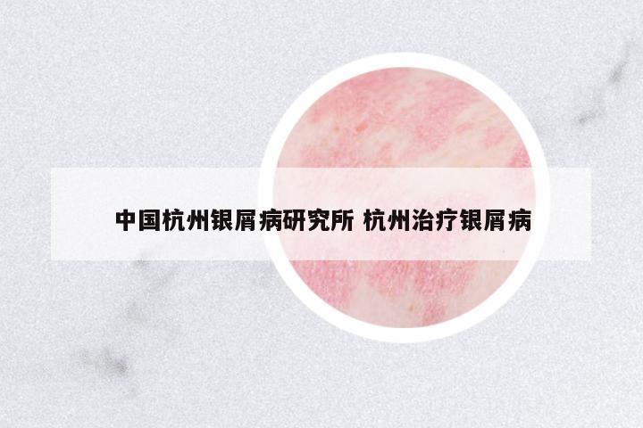 中國(guó)杭州銀屑病研究所 杭州治療銀屑病