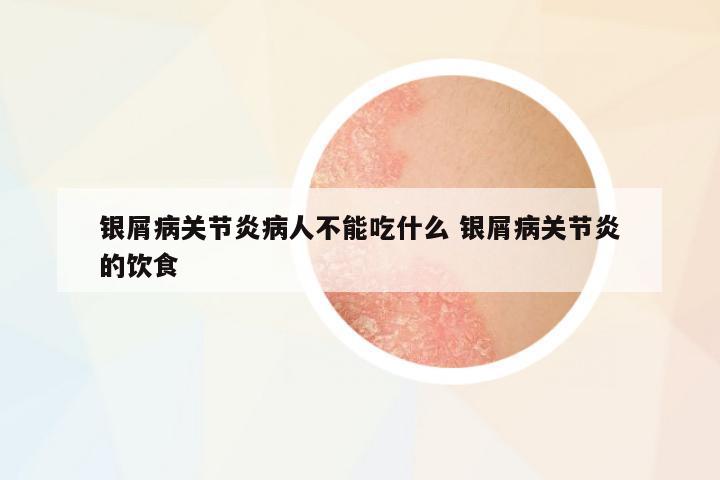 銀屑病關(guān)節(jié)炎病人不能吃什么 銀屑病關(guān)節(jié)炎的飲食