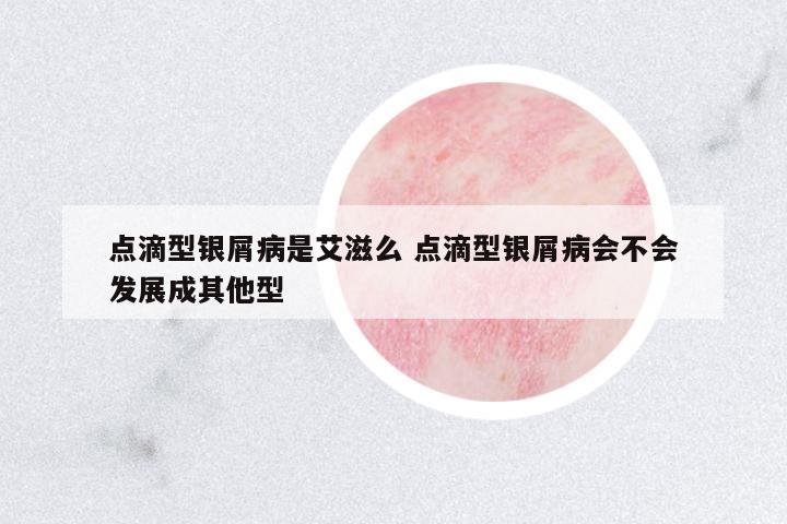 點(diǎn)滴型銀屑病是艾滋么 點(diǎn)滴型銀屑病會(huì)不會(huì)發(fā)展成其他型