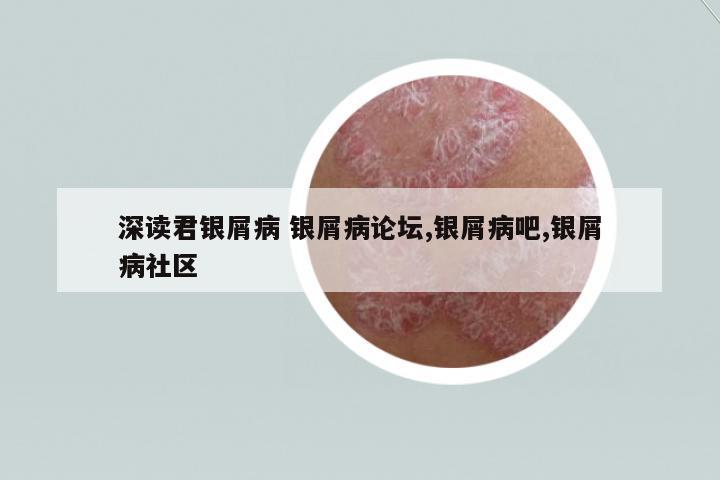 深讀君銀屑病 銀屑病論壇,銀屑病吧,銀屑病社區(qū)