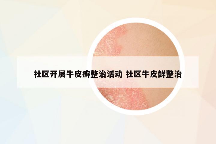 社區(qū)開(kāi)展牛皮癬整治活動(dòng) 社區(qū)牛皮鮮整治