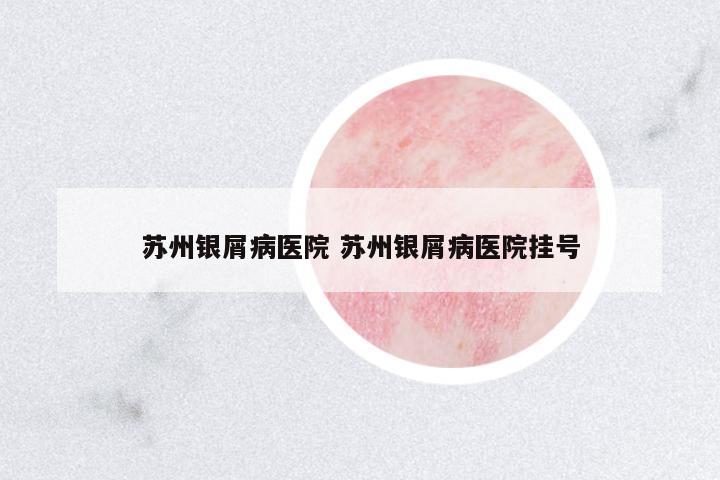 蘇州銀屑病醫(yī)院 蘇州銀屑病醫(yī)院掛號(hào)