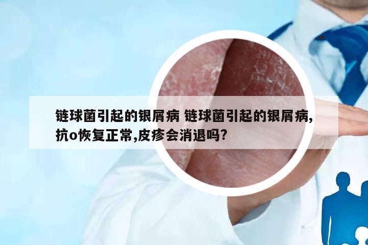 鏈球菌引起的銀屑病 鏈球菌引起的銀屑病,抗o恢復(fù)正常,皮疹會消退嗎?