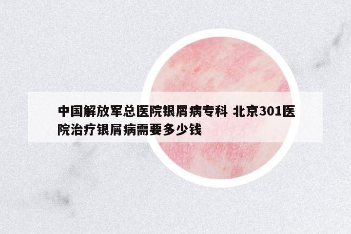 中國(guó)解放軍總醫(yī)院銀屑病專(zhuān)科 北京301醫(yī)院治療銀屑病需要多少錢(qián)