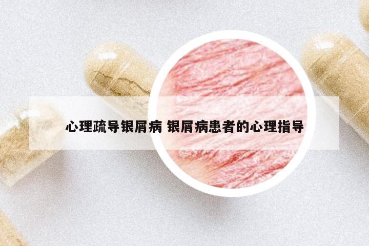 心理疏導(dǎo)銀屑病 銀屑病患者的心理指導(dǎo)