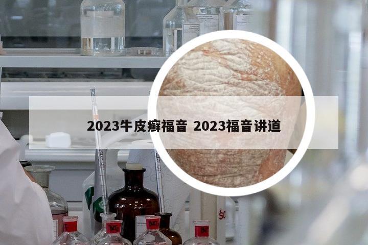 2023牛皮癬福音 2023福音講道