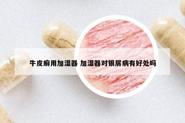 牛皮癬用加濕器 加濕器對(duì)銀屑病有好處嗎