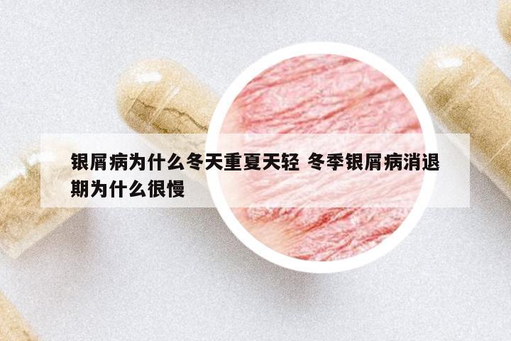 銀屑病為什么冬天重夏天輕 冬季銀屑病消退期為什么很慢