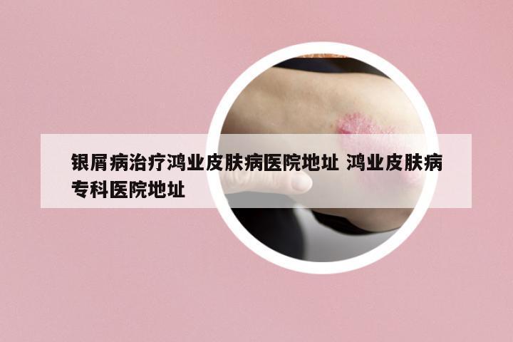銀屑病治療鴻業(yè)皮膚病醫(yī)院地址 鴻業(yè)皮膚病專科醫(yī)院地址