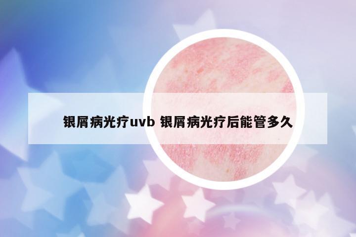銀屑病光療uvb 銀屑病光療后能管多久