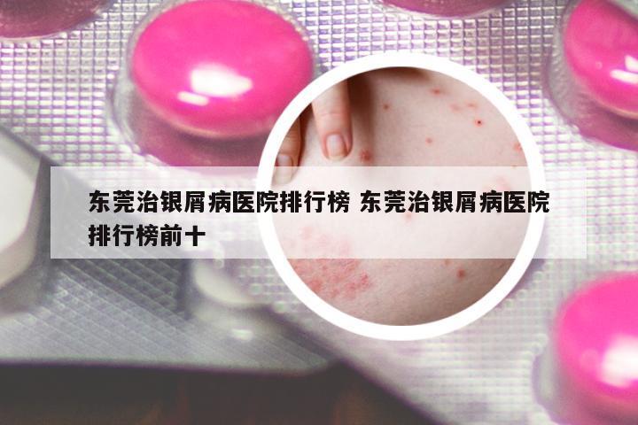 東莞治銀屑病醫(yī)院排行榜 東莞治銀屑病醫(yī)院排行榜前十