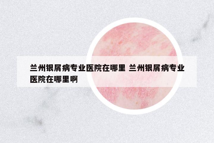 蘭州銀屑病專業(yè)醫(yī)院在哪里 蘭州銀屑病專業(yè)醫(yī)院在哪里啊