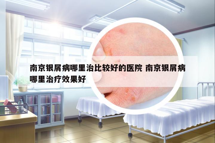 南京銀屑病哪里治比較好的醫(yī)院 南京銀屑病哪里治療效果好