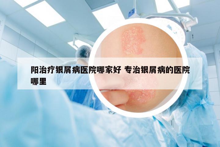 陽治療銀屑病醫(yī)院哪家好 專治銀屑病的醫(yī)院哪里