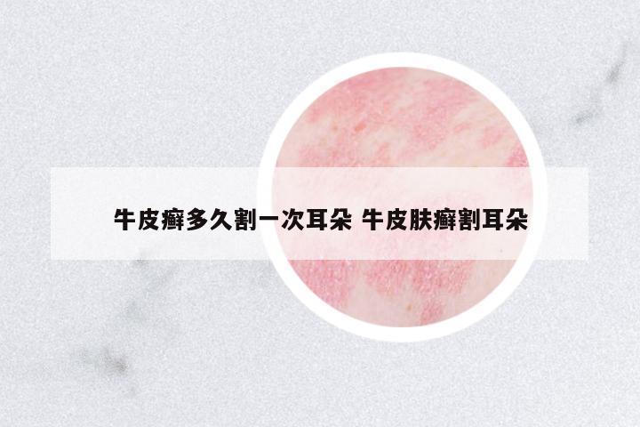 牛皮癬多久割一次耳朵 牛皮膚癬割耳朵