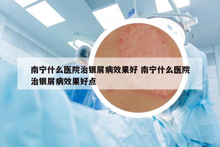 南寧什么醫(yī)院治銀屑病效果好 南寧什么醫(yī)院治銀屑病效果好點(diǎn)