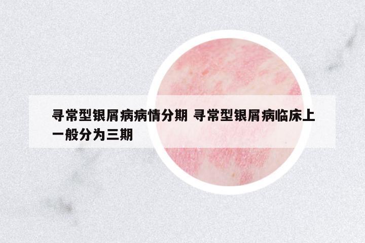 尋常型銀屑病病情分期 尋常型銀屑病臨床上一般分為三期