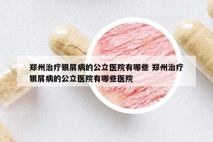 鄭州治療銀屑病的公立醫(yī)院有哪些 鄭州治療銀屑病的公立醫(yī)院有哪些醫(yī)院