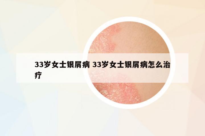 33歲女士銀屑病 33歲女士銀屑病怎么治療