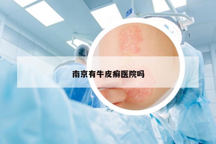 南京有牛皮癬醫(yī)院嗎