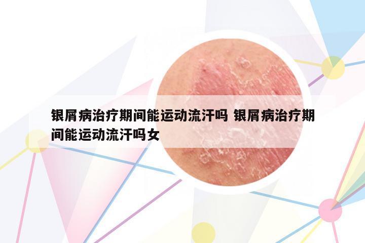 銀屑病治療期間能運動流汗嗎 銀屑病治療期間能運動流汗嗎女